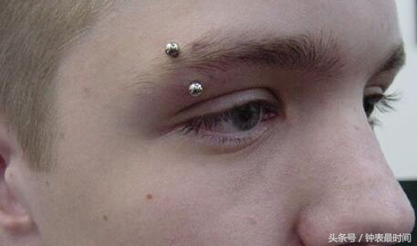 对自己血清过敏是什么原因,手表表盘过敏怎么处理