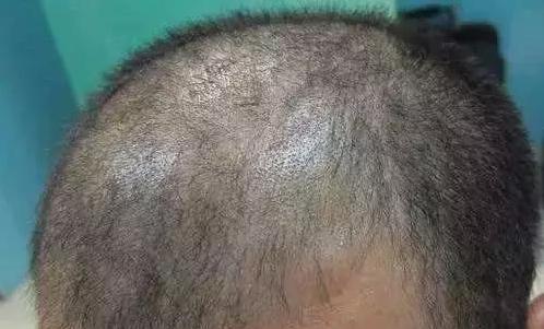 现在治脱发产品靠谱吗,治脱发产品介绍