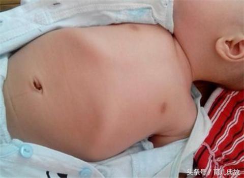 十一个月宝宝肋骨外翻是缺钙吗,怎样区分遗传还是缺钙性肋骨外翻