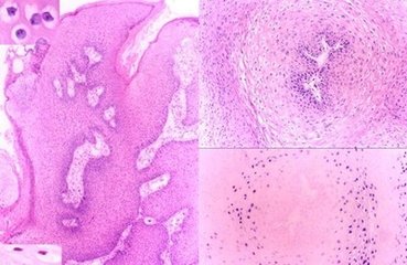 std性传染病,什么支原体感染属于性传播疾病