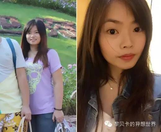 她们说||那些年整牙吞下的血和泪,终于换来最开怀的大笑