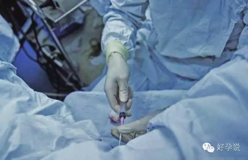 存放十年的胚胎,保存生胚