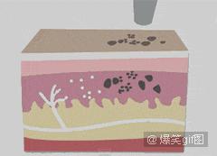 这样的文身，女孩涂后红疹起泡留疤都来了，你还敢玩吗？