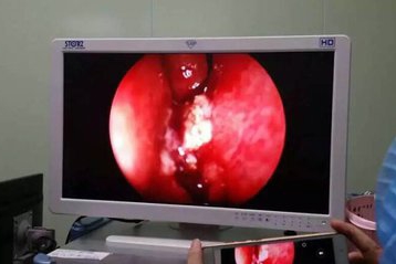 小孩鼻源性头疼如何缓解,孩子头痛却查不出原因