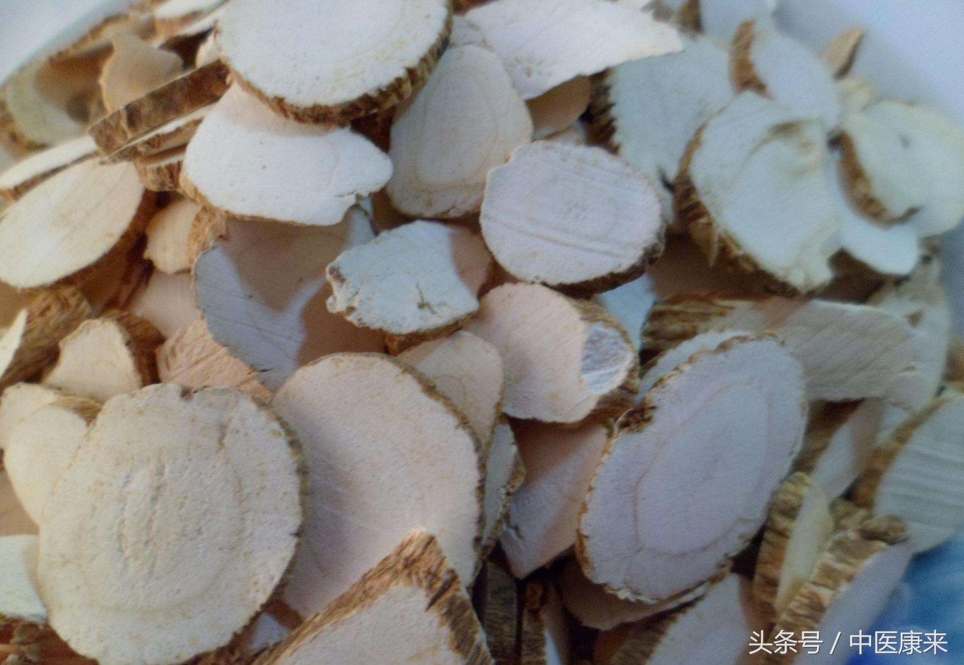 偏头痛无药可治,偏头痛有没有偏方治