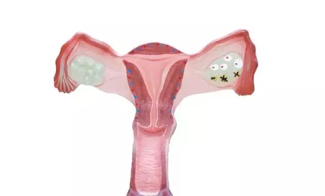 宫颈糜烂与宫颈癌有关吗？会致不孕吗？关于宫颈糜烂的7问7答