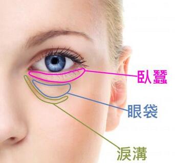 眼袋的形成原因及处理办法,眼袋的形成原因和治疗方法