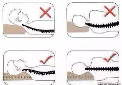 乳胶枕可以治疗颈椎病吗,乳胶枕那么软真的能缓解颈椎病吗