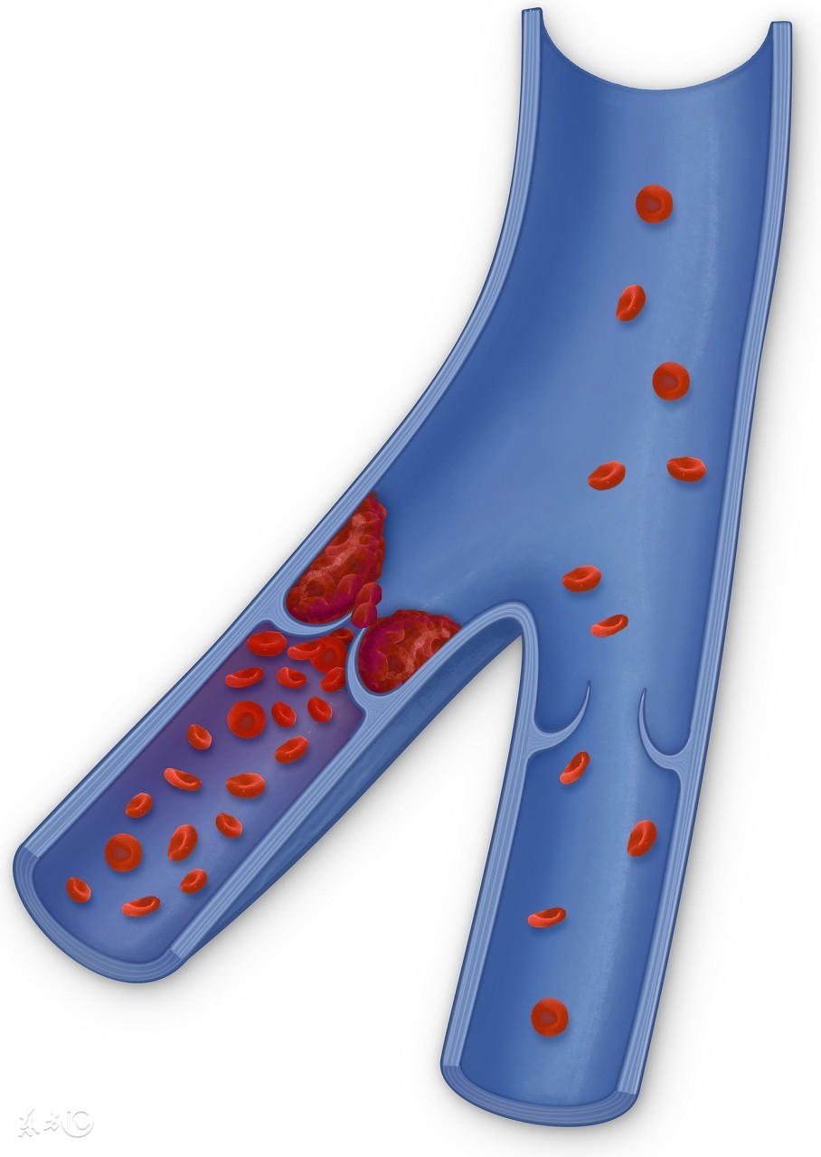 过期食用油的危害有哪些,用了过期的食用油有什么危害
