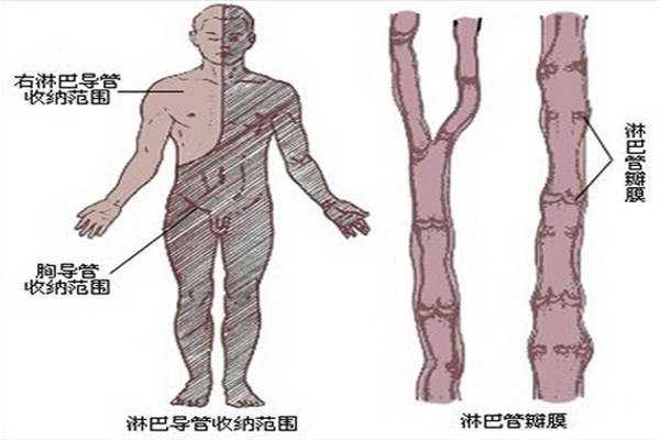 淋巴水肿皮肤发硬怎么治疗,淋巴水肿患者的早期症状