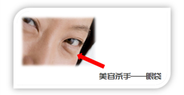 眼袋的成因与日常护理,眼袋的成因和改善方法