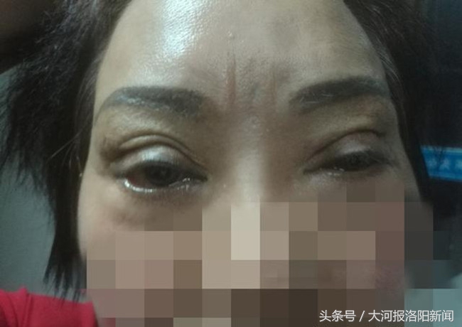 北京协和医院美容专家,皮肤美容科专家北京协和