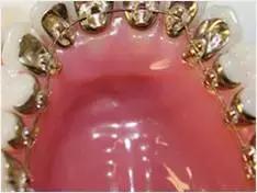 俗话说牙缝大会漏财,两边牙缝大漏财还是进财