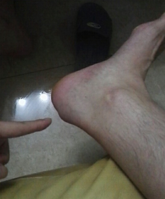 网球肘详细讲解,网球肘的最佳打法