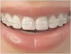 牙缝大漏财有什么说法,牙齿牙缝太宽会漏财吗