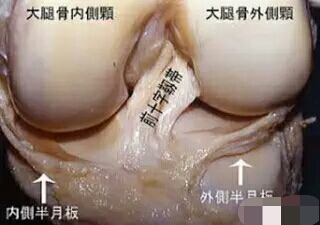 膝关节韧带受伤严重怎么处理,膝关节韧带损伤怎么算好了