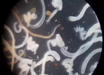 怎么有效杀死土里的虫子,杀死虫子办法有哪些呢