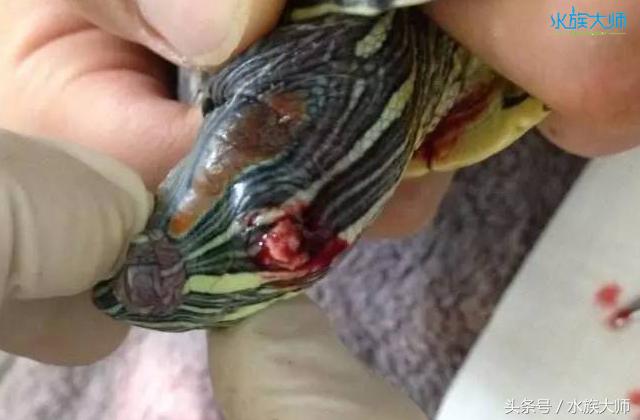 龟中耳炎手术多久消肿,龟中耳炎能用碘伏吗