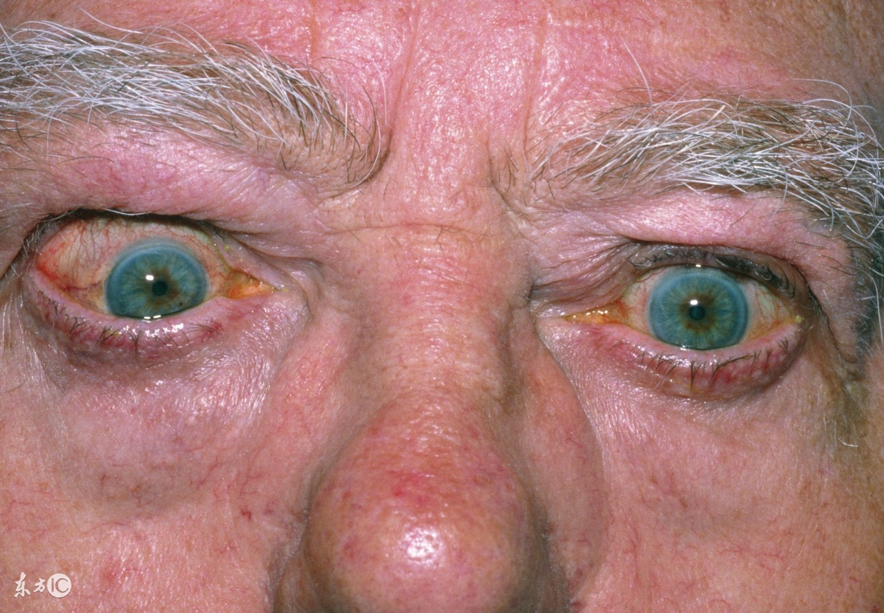 年轻人手抖的10大疾病征兆是什么,老年人手抖腿抖是什么病的征兆