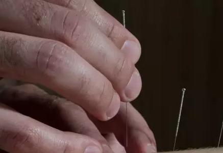 膝关节炎的针灸治疗的穴位,膝关节炎针灸五针疗法用何穴