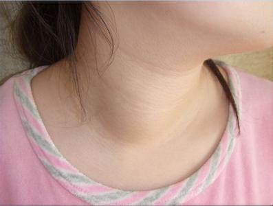 脖子上长疙瘩会是癌症吗,36岁男人脖子上长疙瘩图片大全