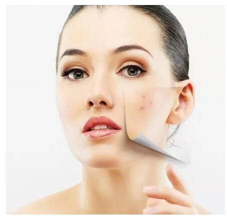 用化妆品脸过敏干燥起皮紧绷发红,脸过敏干皮怎么缓解