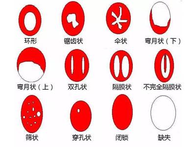 女子去医院检查发现要生了,意外怀二胎去医院才知道