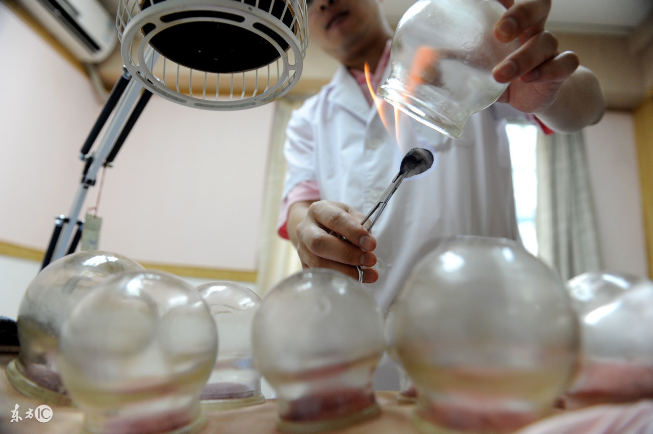 女士祛除湿气一般拔罐多久,拔罐能祛除人体湿气吗