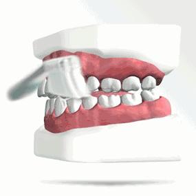 2岁宝宝牙齿龋齿很严重怎么办,大人帮着孩子刷牙还是龋齿怎么办