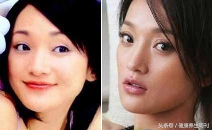 99%的人不知道的眼型,99%的人不知道眼睛的秘密