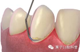 月子牙刷有必要买吗,月子牙刷和普通牙刷的区别