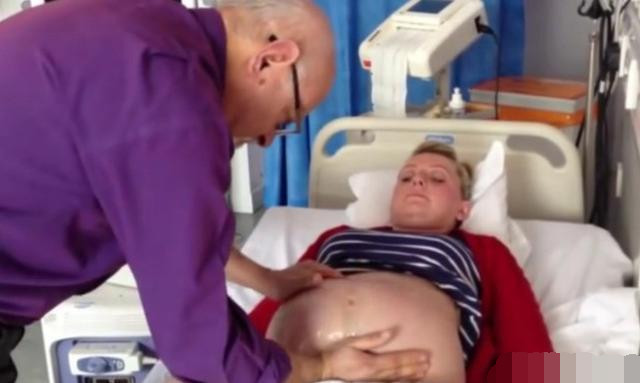 胎位不正胎儿的姿势,胎儿胎位不正怎么转过来