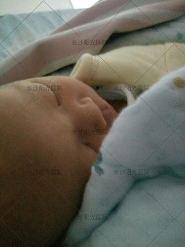 结扎以后还想怀孕有什么方法吗,女的结扎还可以生二胎吗