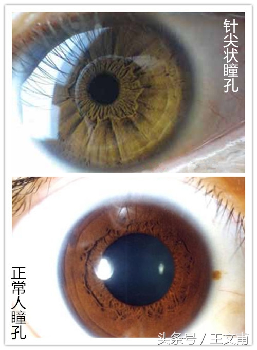 常喝咖啡对身体有害吗?,咖啡对人的身体是否有害