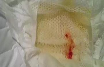 刚出生女宝宝尿布上有血啥原因,新生女宝宝尿布有血