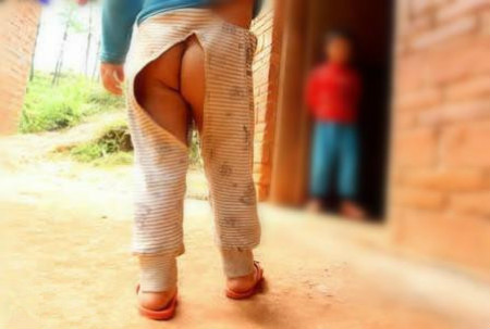 小便尿完痛还带血怎么回事,五岁女童尿后出血