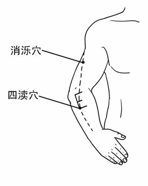 糖尿病高血压可以在家简单艾灸吗,糖尿病怎么自己艾灸