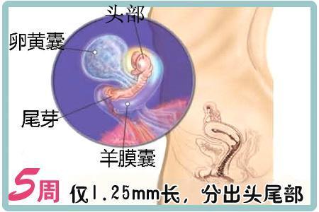 怀孕第11周孕妇症状,怀孕初期吸入甲醛孕妇什么症状