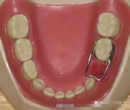 心疼龋齿宝宝——看口腔科比看感冒还多的漫漫看牙路