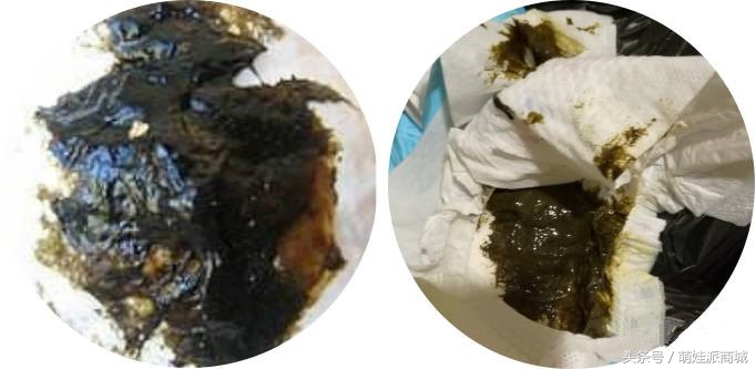 宝宝绿便的十种原因,12种绿便成因