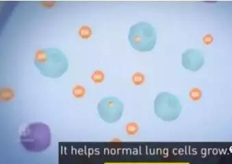 肺癌晚期医生下病危通知能活多久,肺癌晚期从发现到死亡1年半