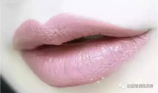重度乌唇怎么改善能变红唇,乌唇应该用什么颜色做唇好看