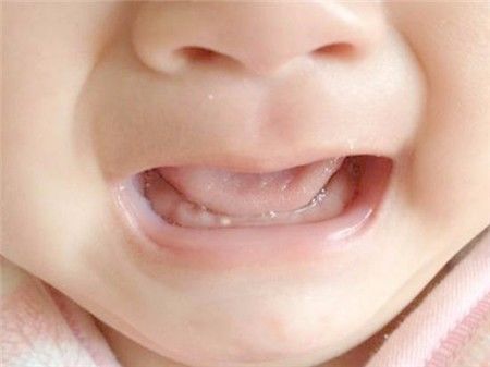 新生儿嘴上有白点怎么回事,新生儿嘴上有白泡