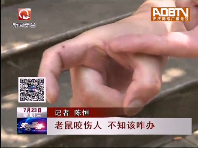 老鼠咬伤手指需要打狂犬疫苗吗,老鼠咬伤后多久打疫苗