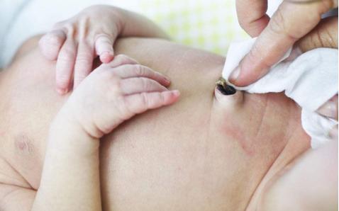 肚脐泥究竟能不能抠,肚脐里的泥能不能抠