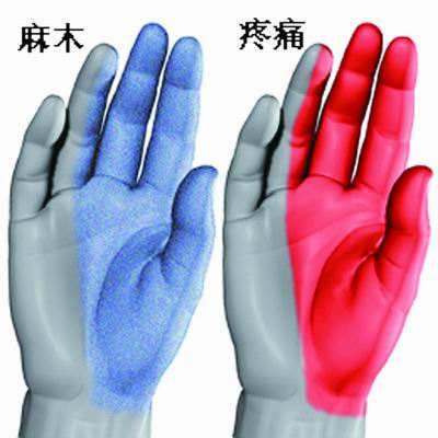 中指发麻警惕四种病,晨起时手指麻木是什么原因