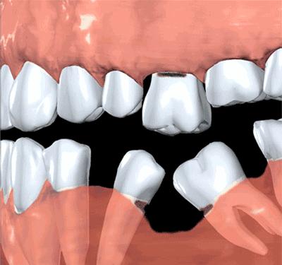 打麻将讲三缺一还是四缺一,打麻将三缺一还是三缺一