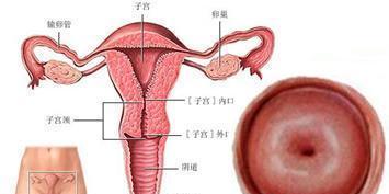 中药治疗慢性宫颈炎,慢性宫颈炎会变成宫颈癌吗
