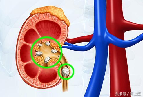 尿液哪个指标可以看出肾功能异常,尿液异常原因有哪些