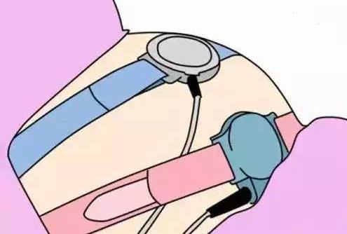 从孕32周后，一定要做这项检查，能最快最直接判断胎儿健康情况